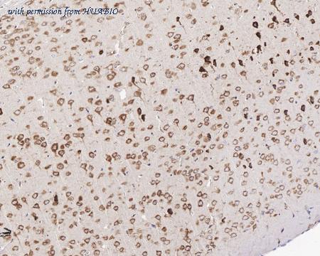 HUABIO HA721338 image 2