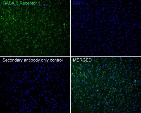 HUABIO HA721338 image 3