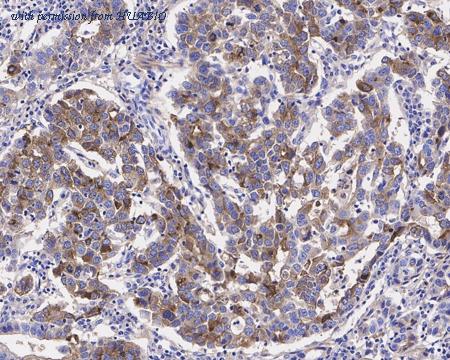 HUABIO HA721355 image 2