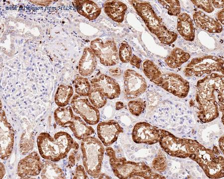 HUABIO HA721359 image 2