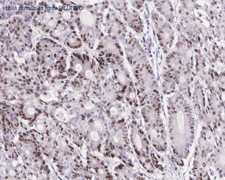 HUABIO HA721365 image 2