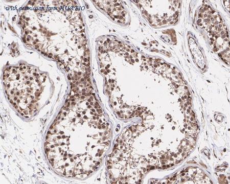 HUABIO HA721365 image 3