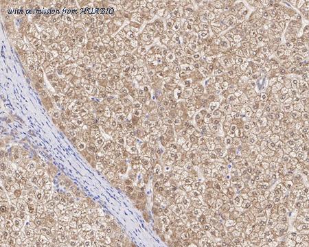 HUABIO HA721366 image 2