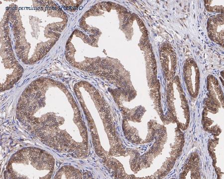 HUABIO HA721366 image 3