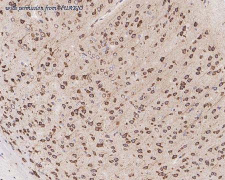 HUABIO HA721375 image 2