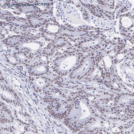 HUABIO HA721376 image 2