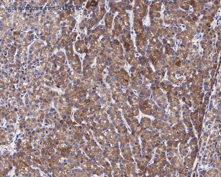 HUABIO HA721381 image 2