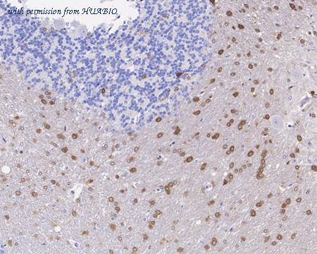 HUABIO HA721384 image 3