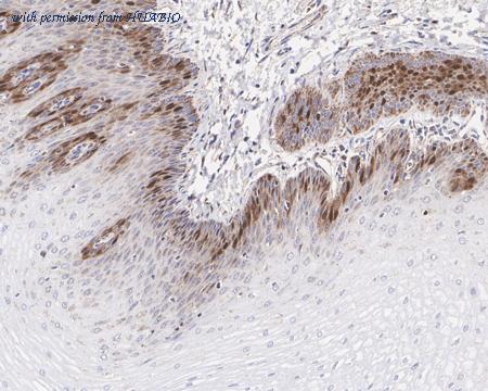 HUABIO HA721389 image 2