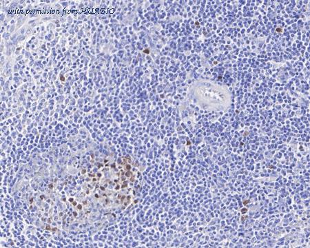 HUABIO HA721389 image 3