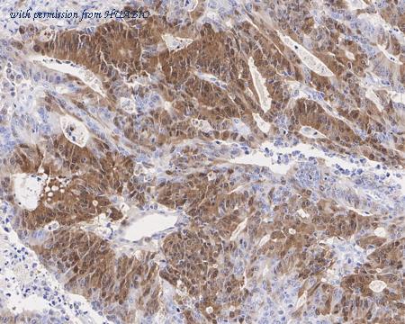 HUABIO HA721394 image 2