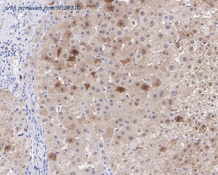 HUABIO HA721394 image 3