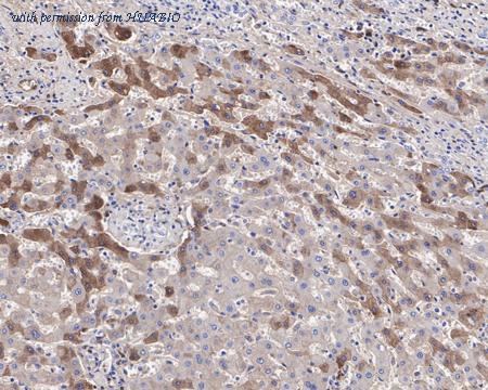 HUABIO HA721397 image 2