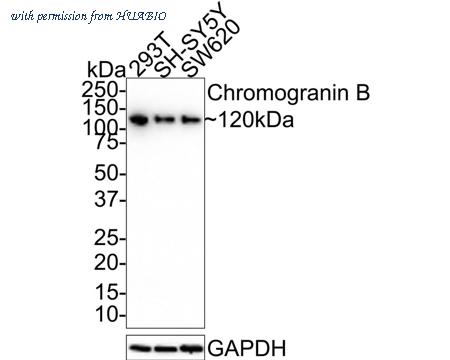 HUABIO HA721398 image 1