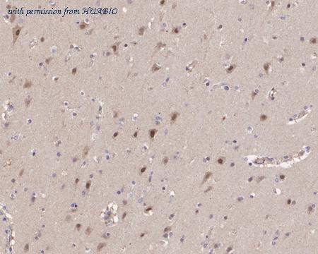 HUABIO HA721399 image 2