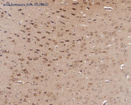 HUABIO HA721399 image 3