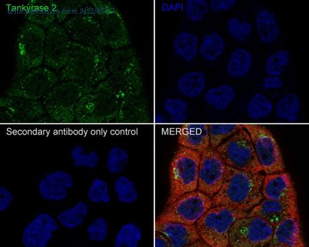 HUABIO HA721400 image 3