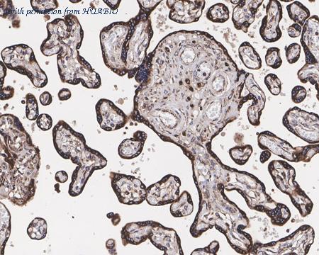 HUABIO HA721417 image 2