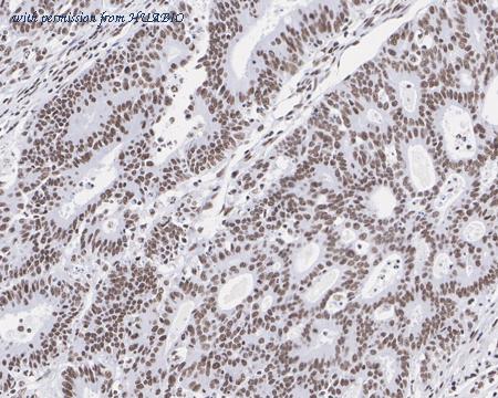 HUABIO HA721419 image 2