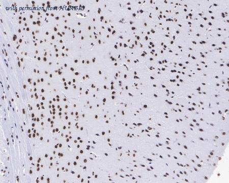 HUABIO HA721424 image 3