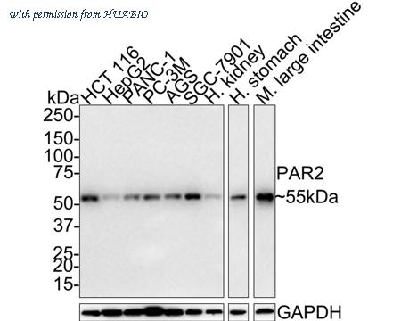 HUABIO HA721426 image 1