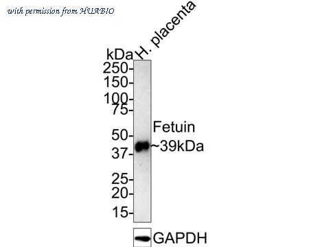 HUABIO HA721436 image 1