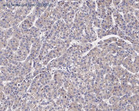 HUABIO HA721436 image 3