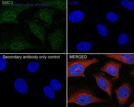 HUABIO HA721451 image 3