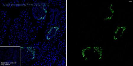 HUABIO HA721460 image 2