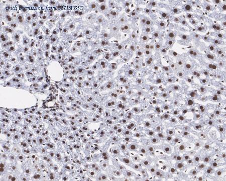 HUABIO HA721466 image 3