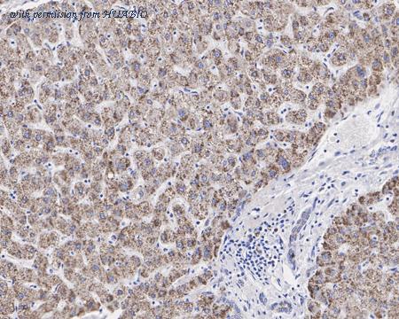 HUABIO HA721476 image 3