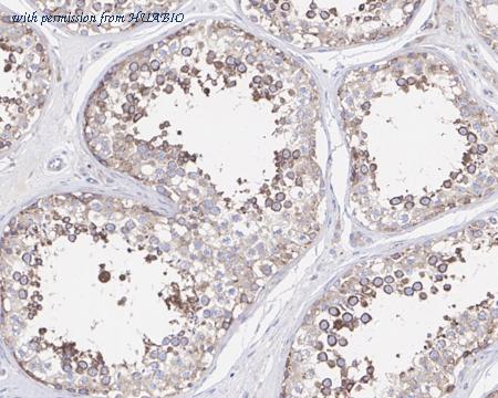 HUABIO HA721484 image 2