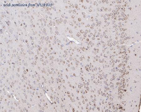 HUABIO HA721491 image 2