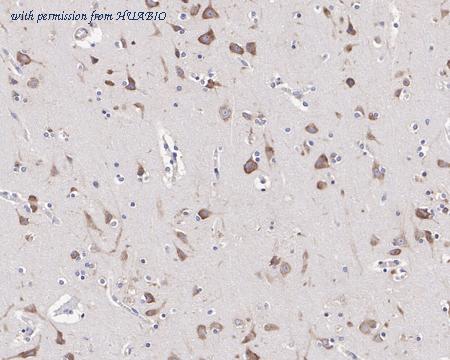 HUABIO HA721499 image 2