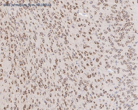 HUABIO HA721499 image 3