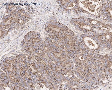 HUABIO HA721503 image 3