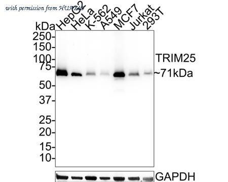 HUABIO HA721506 image 1