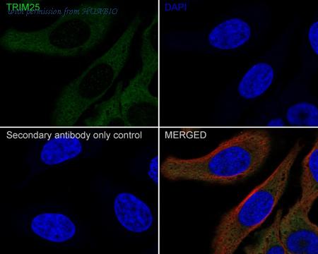 HUABIO HA721506 image 3