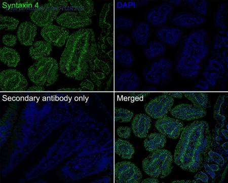 HUABIO HA721509 image 2