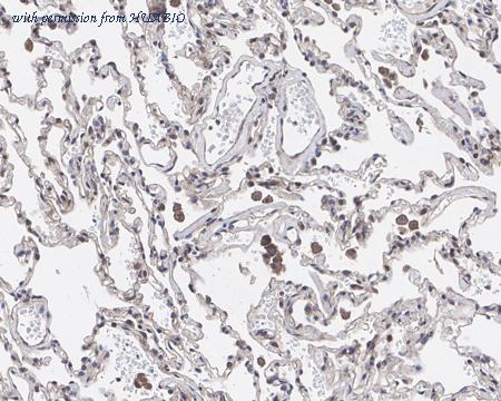 HUABIO HA721511-50UL image 3