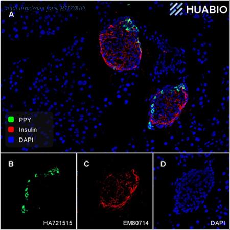 HUABIO HA721515 image 1