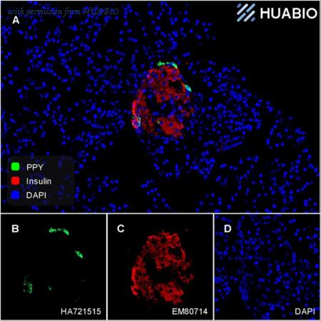 HUABIO HA721515 image 2