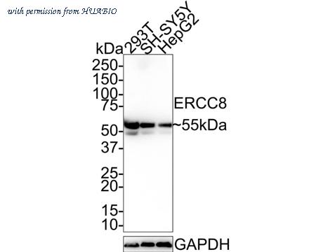 HUABIO HA721522 image 1