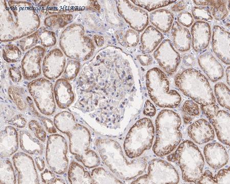 HUABIO HA721534 image 2