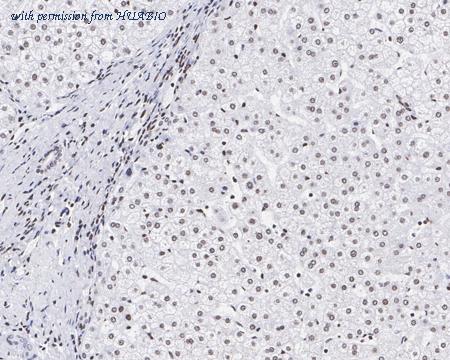 HUABIO HA721540 image 2