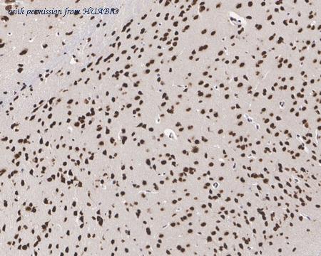 HUABIO HA721540 image 3