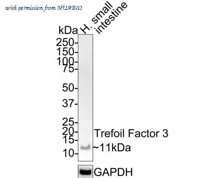 HUABIO HA721541 image 1