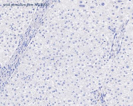 HUABIO HA721541 image 3