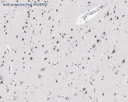 HUABIO HA721543 image 2