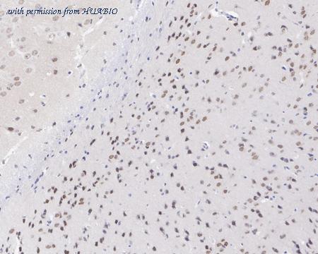 HUABIO HA721543 image 3